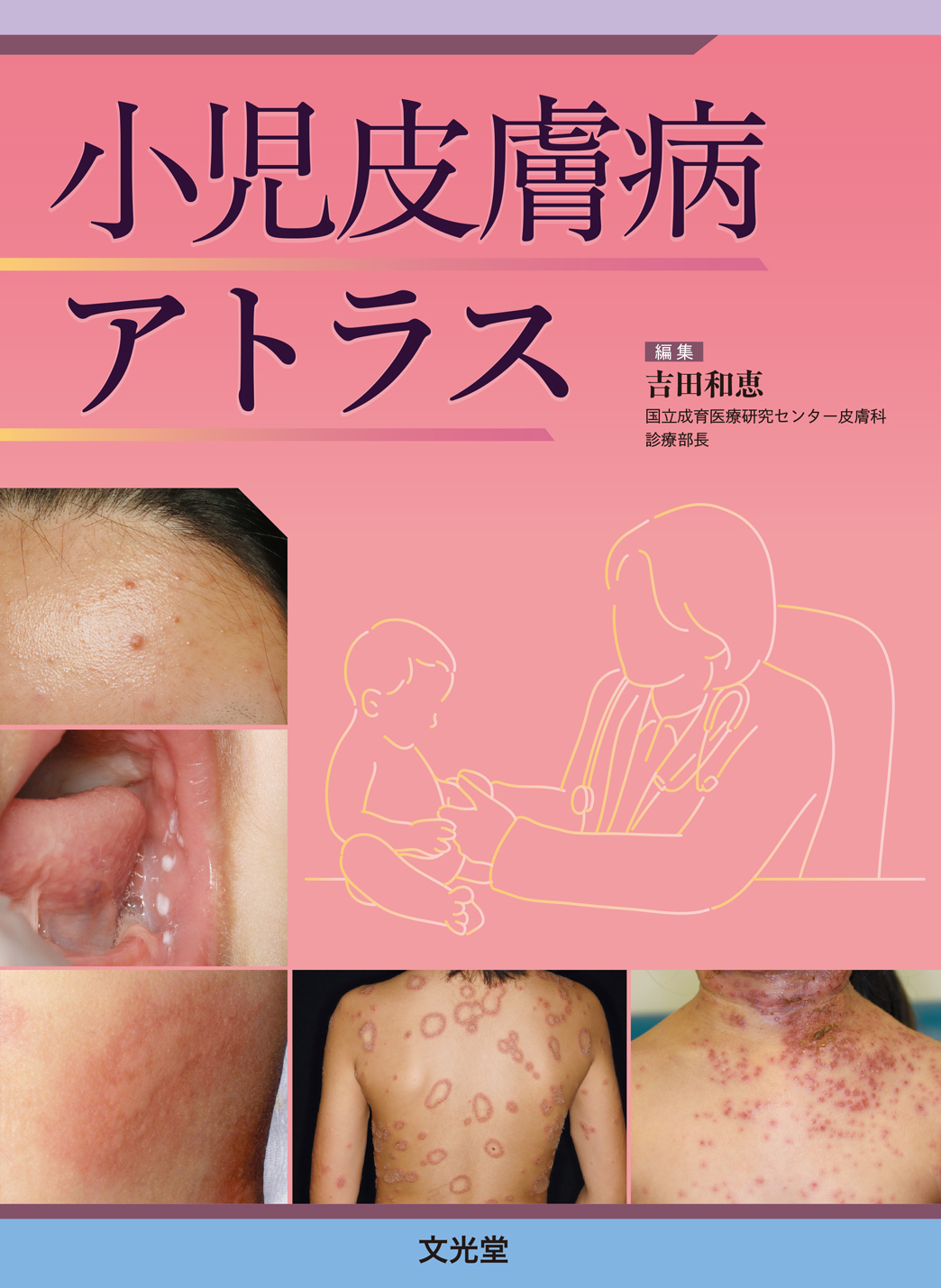 サムネイル画像1