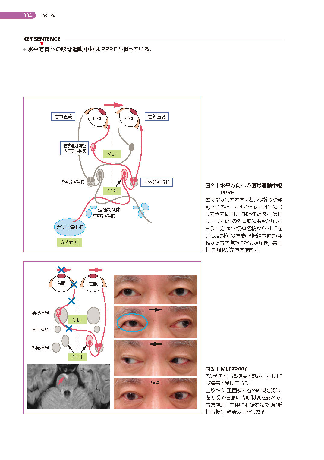 サムネイル画像4