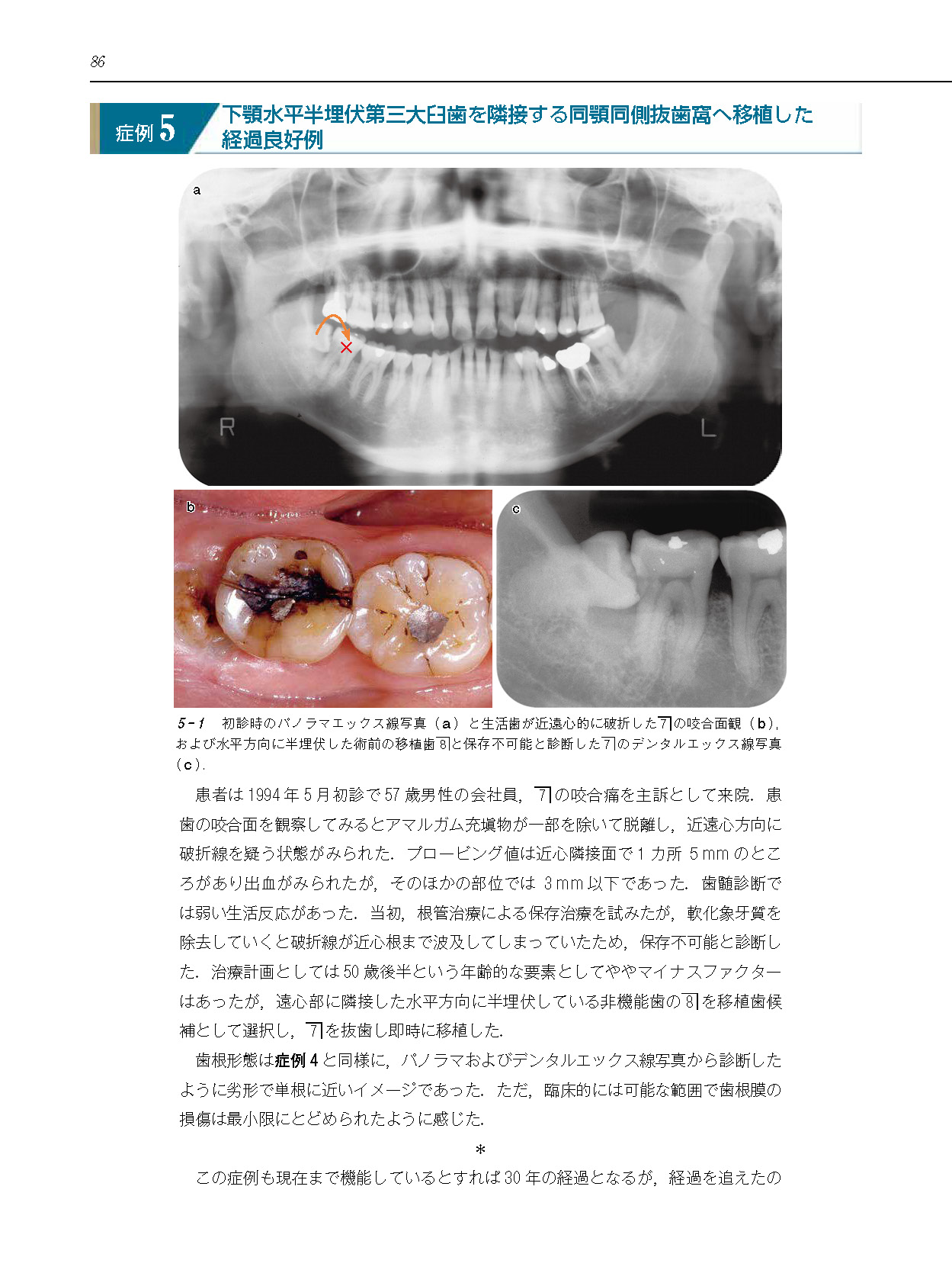 サムネイル画像5