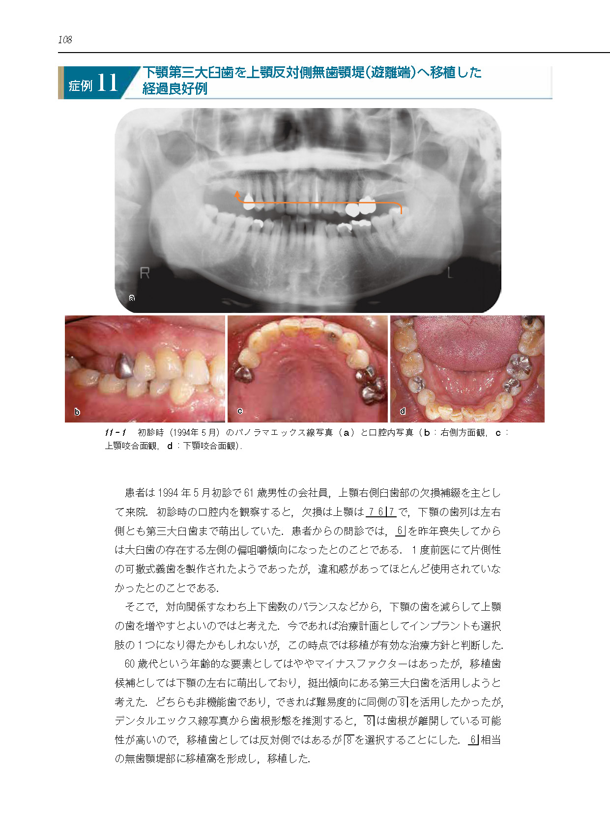 サムネイル画像6