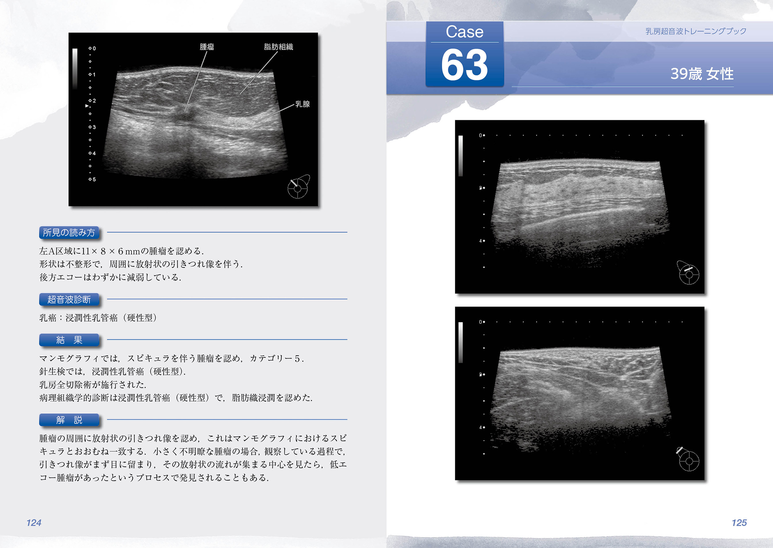 サムネイル画像3