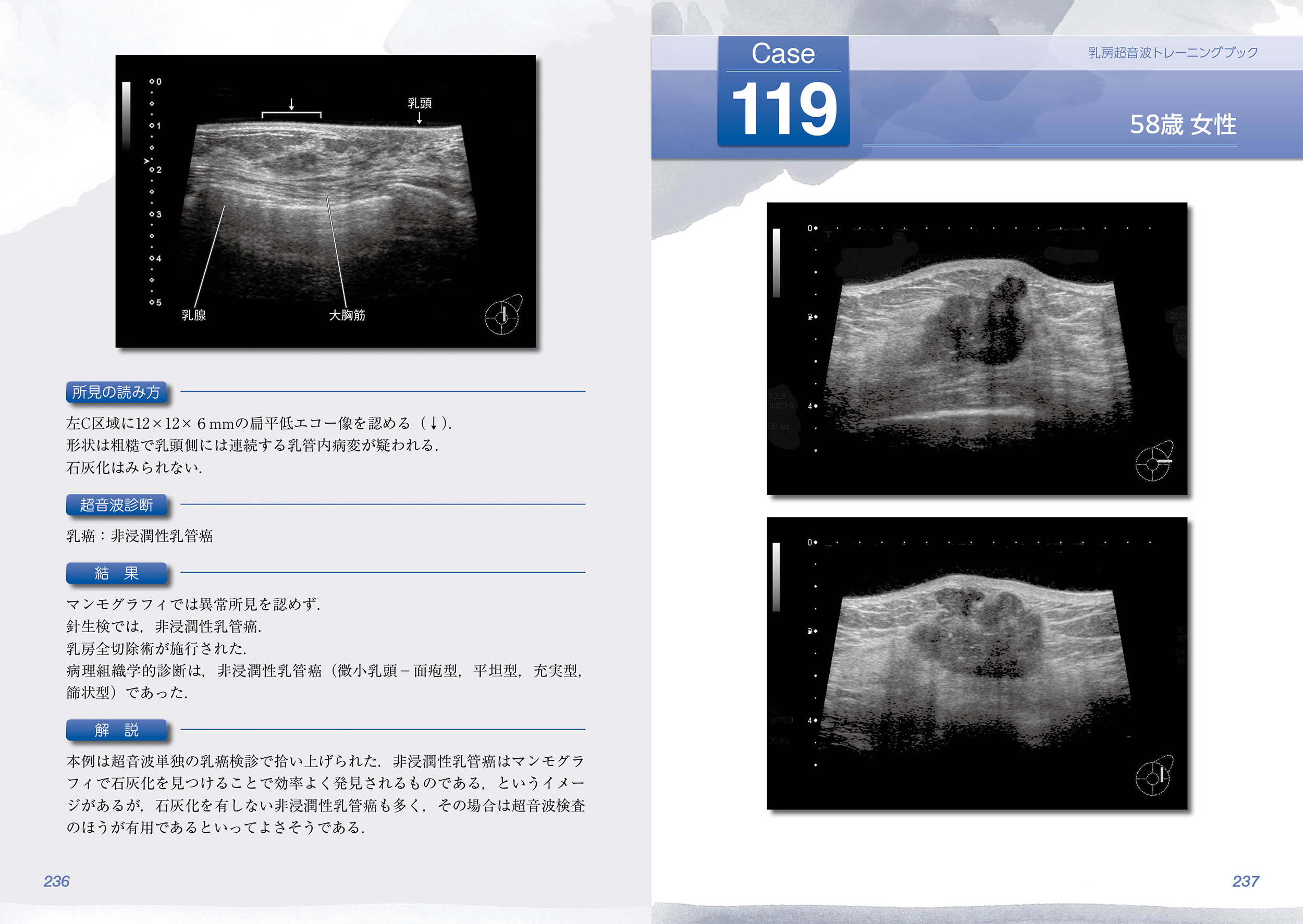 サムネイル画像4