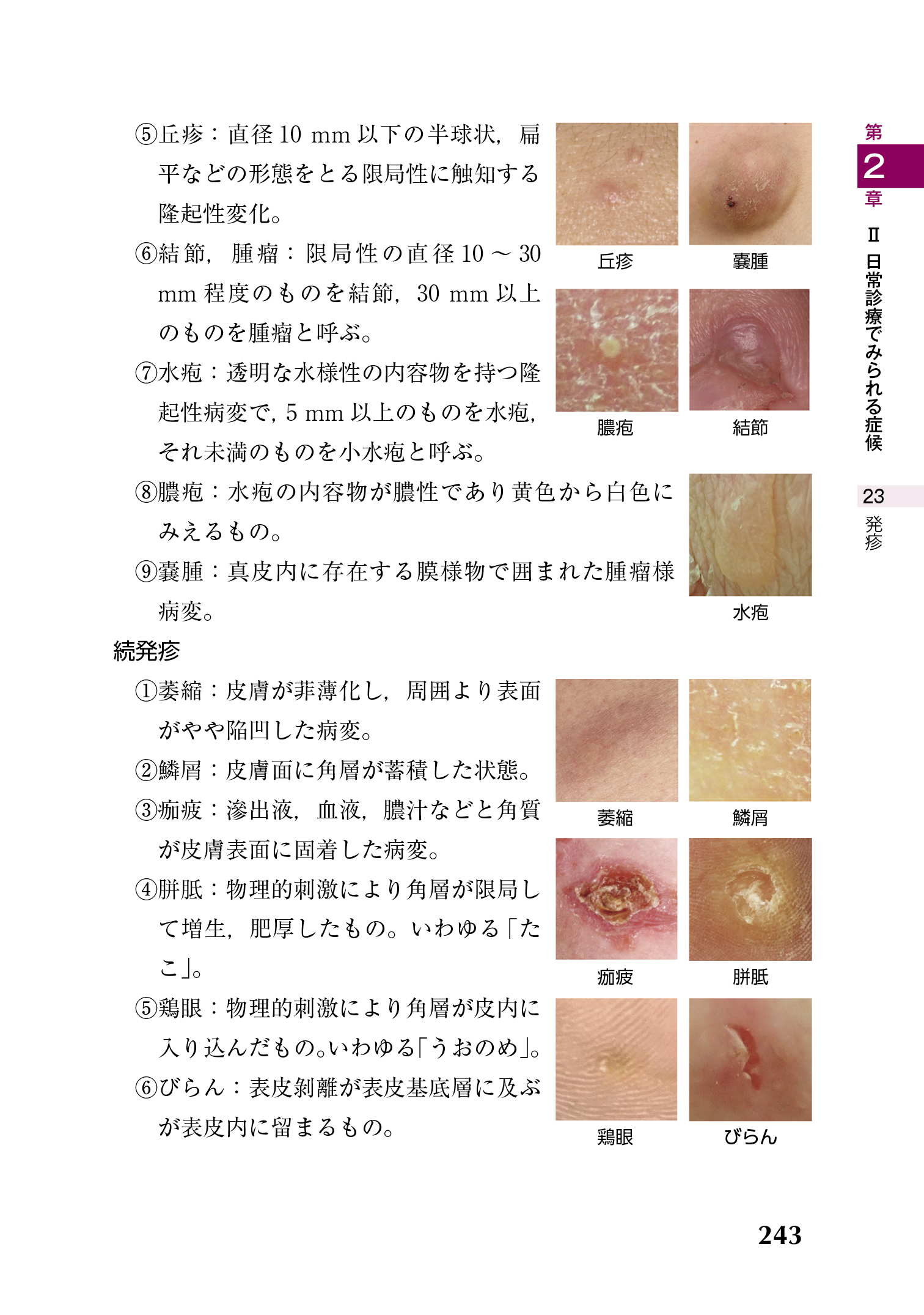 サムネイル画像4