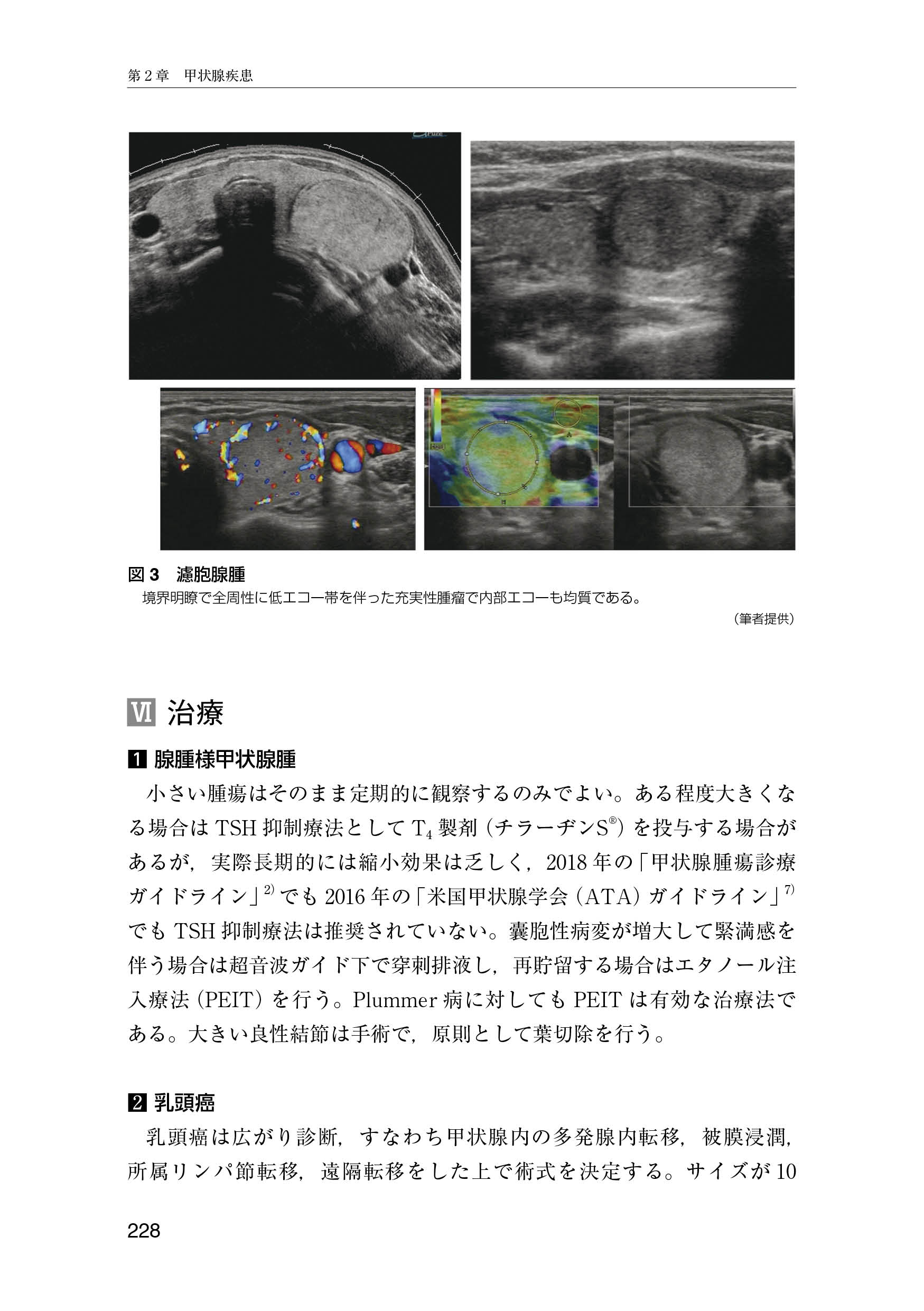 サムネイル画像4