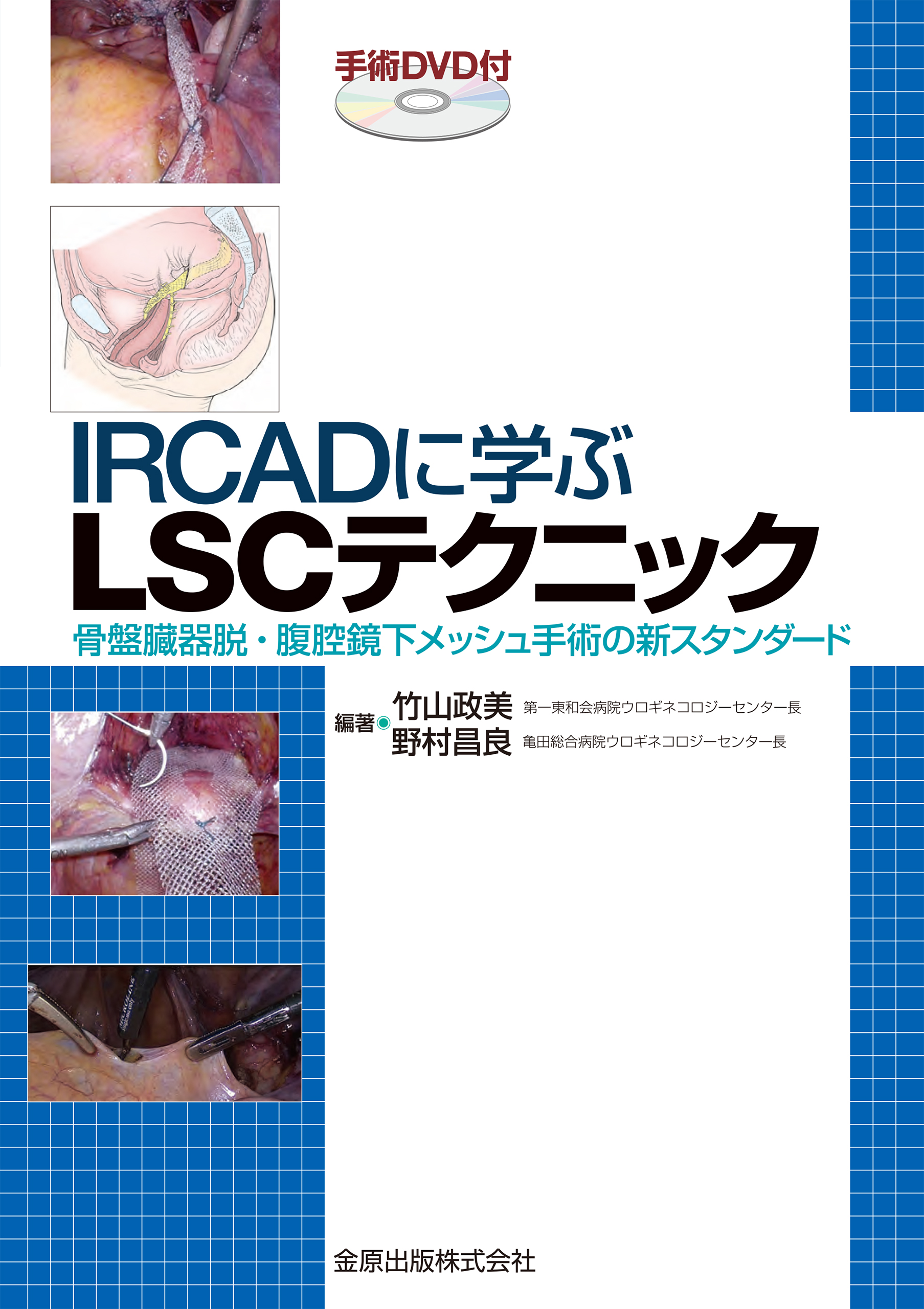 IRCADに学ぶLSCテクニック（手術DVD付）の商品画像