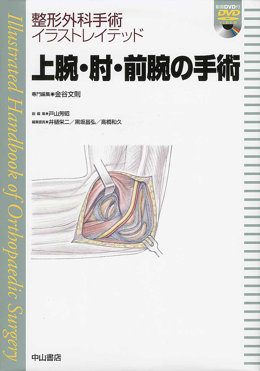 上腕・肘・前腕の手術（DVD付き）の商品画像