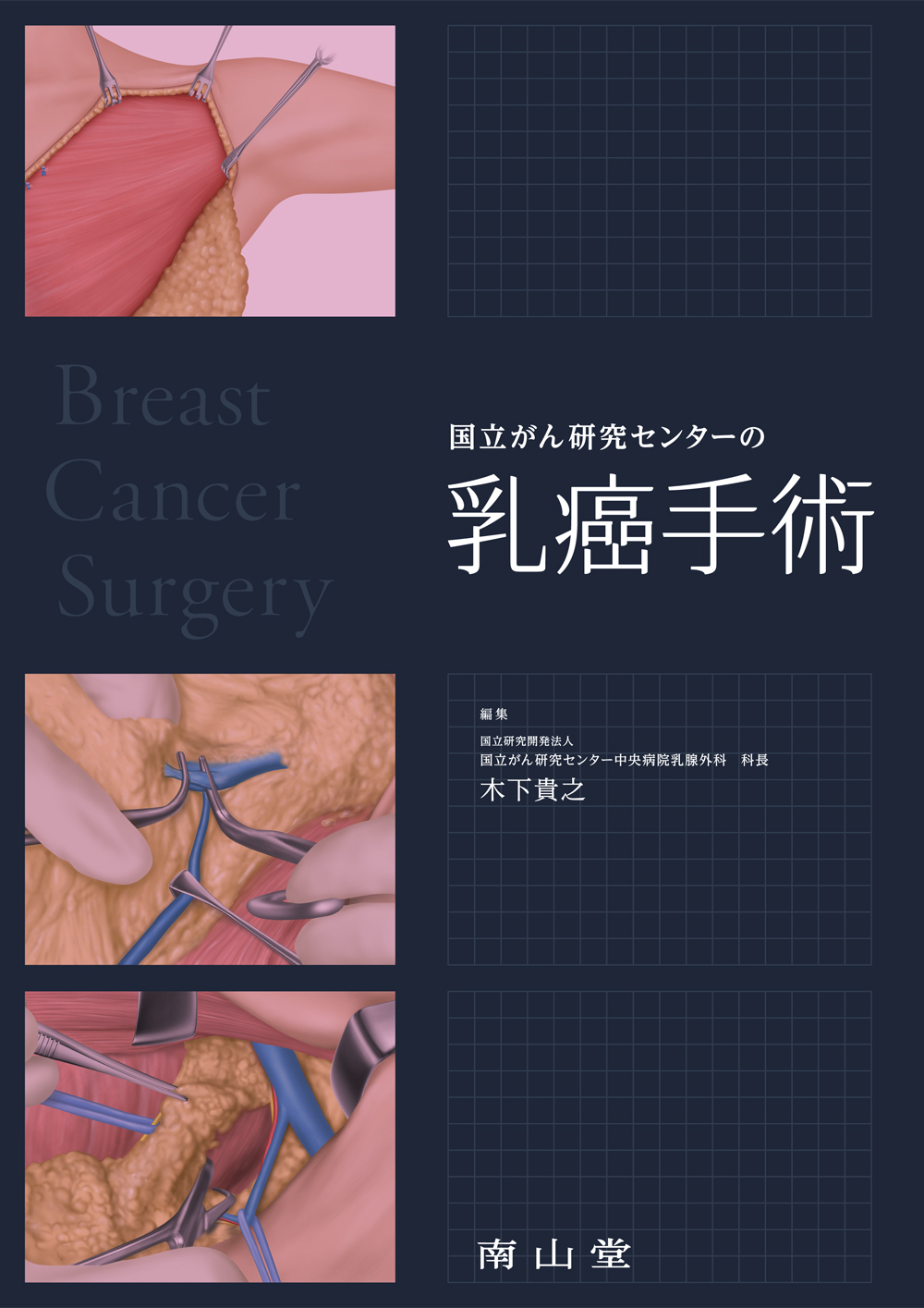 国立がん研究センターの乳癌手術の商品画像