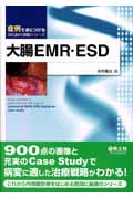 大腸EMR・ESDの商品画像