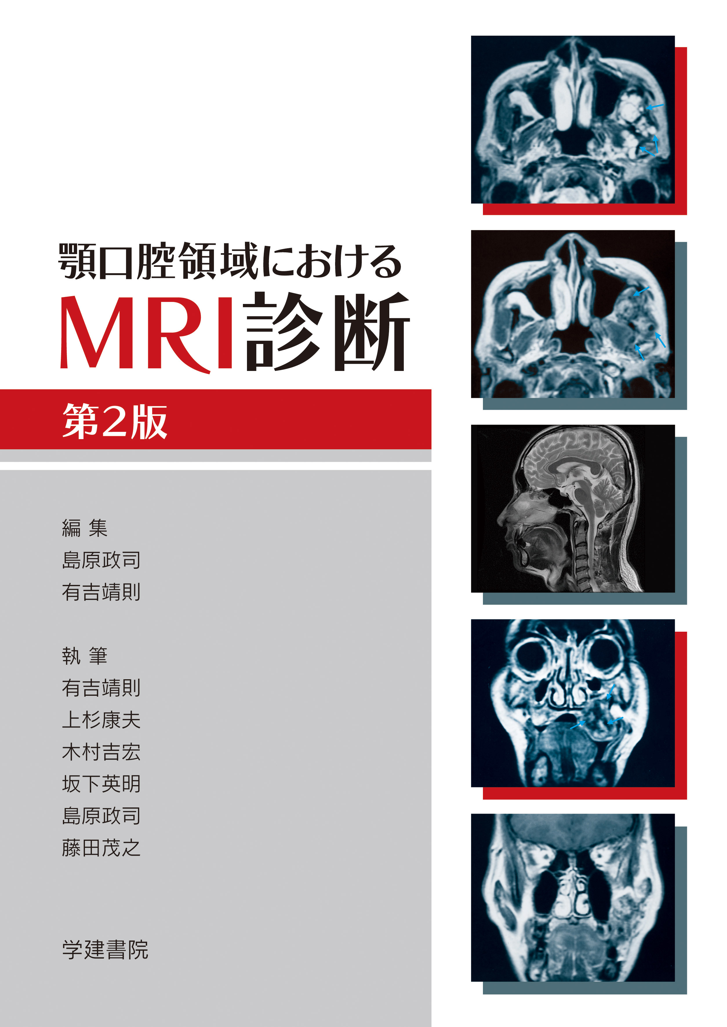 顎口腔領域におけるMRI診断の商品画像