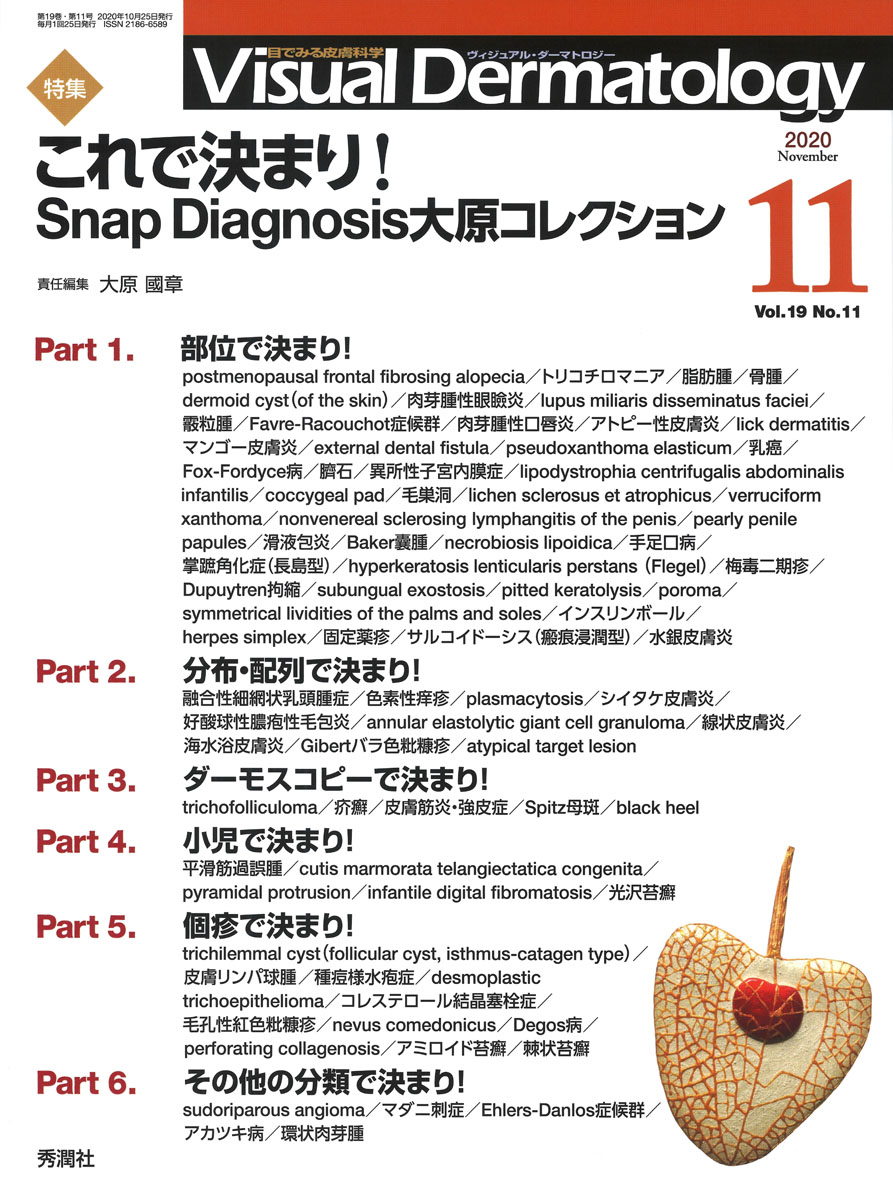 Visual Dermatology　2020年11月号（Vol.19　No.11）の商品画像