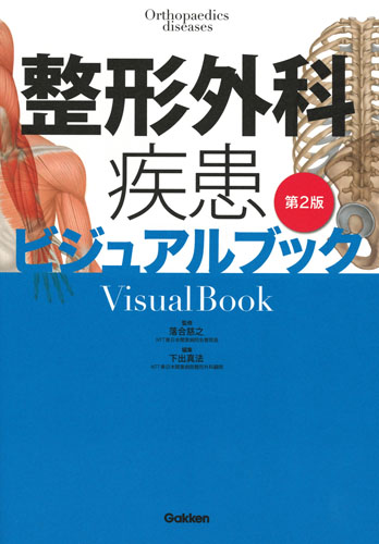 整形外科疾患ビジュアルブックの商品画像
