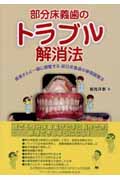 部分床義歯のトラブル解消法の商品画像