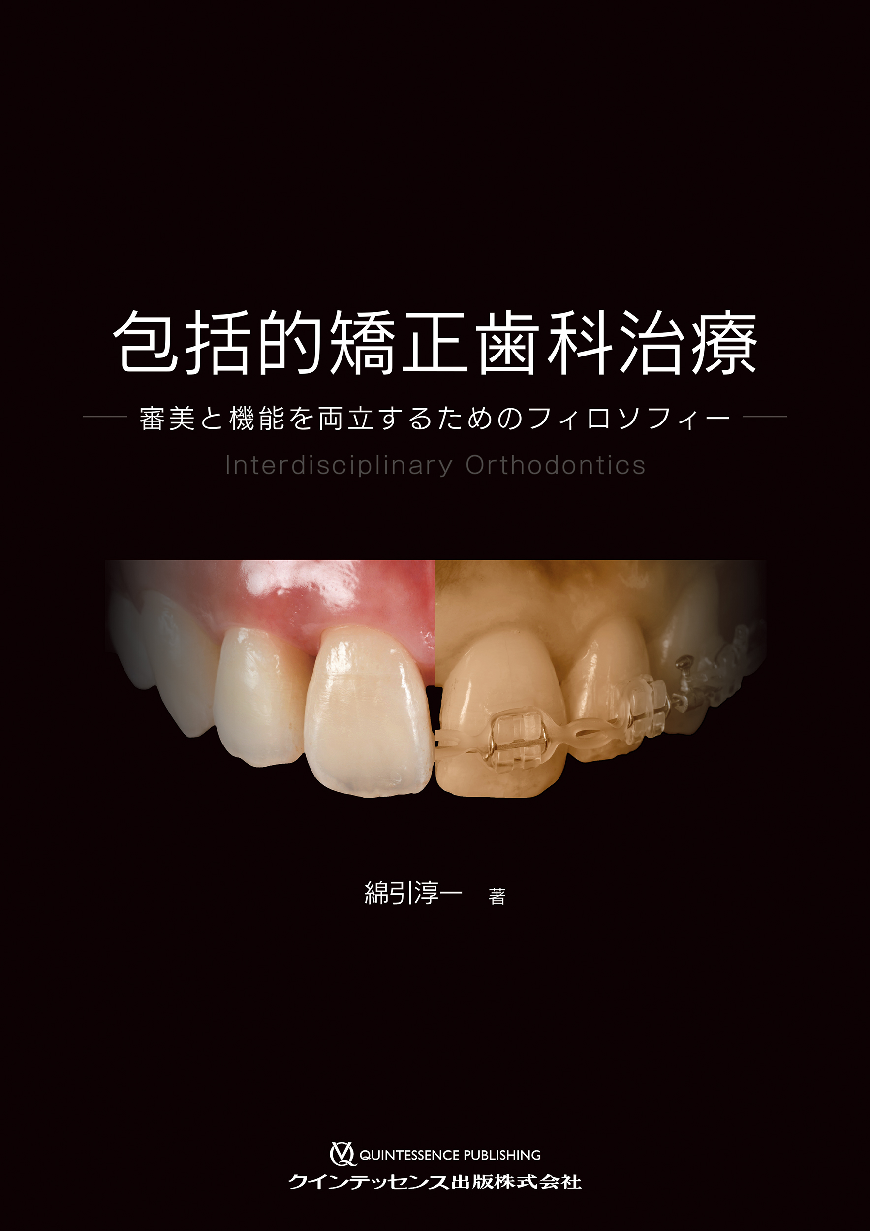 包括的矯正歯科治療の商品画像