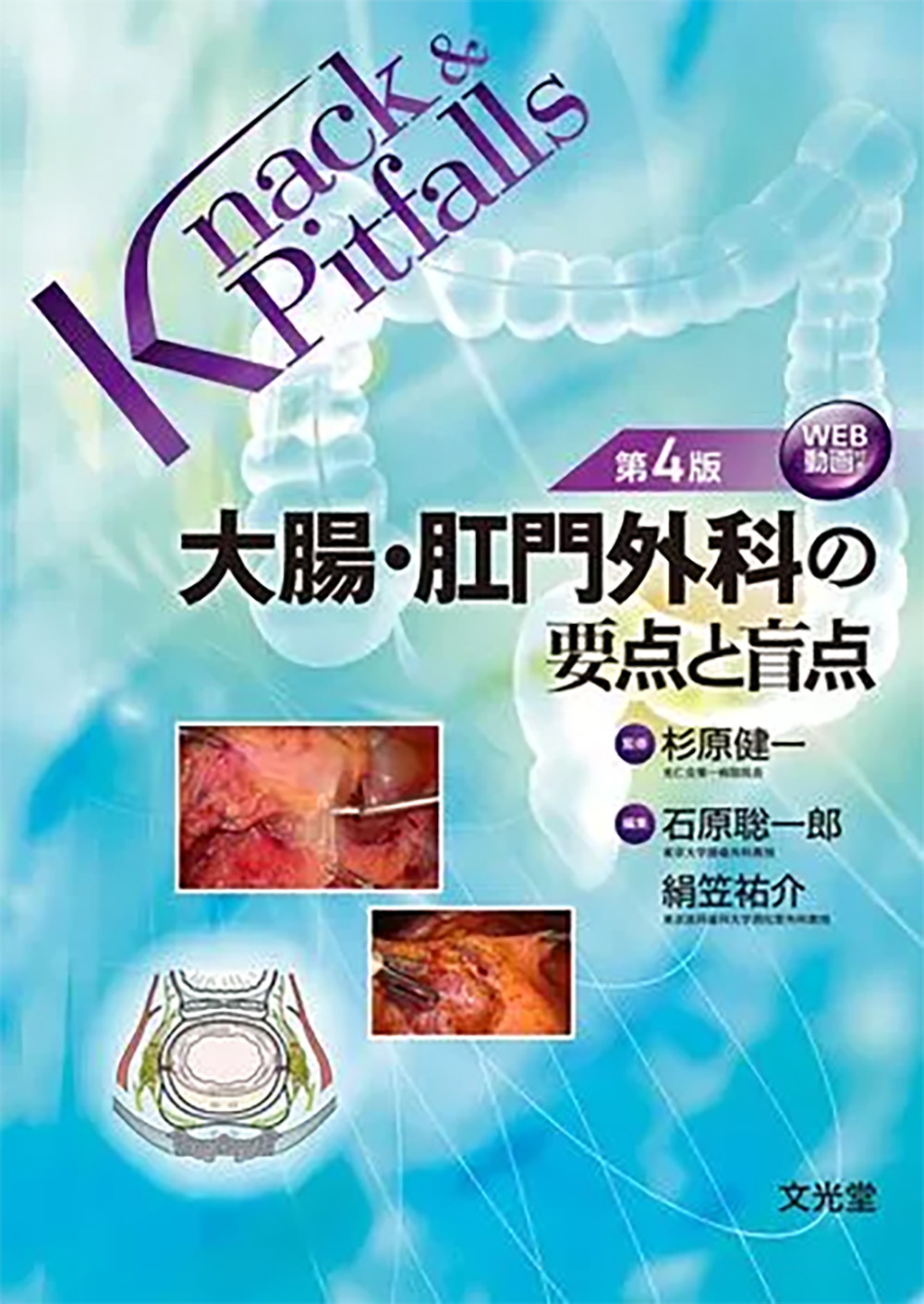 大腸・肛門外科の要点と盲点 第4版 (Knack & Pitfalls)の商品画像