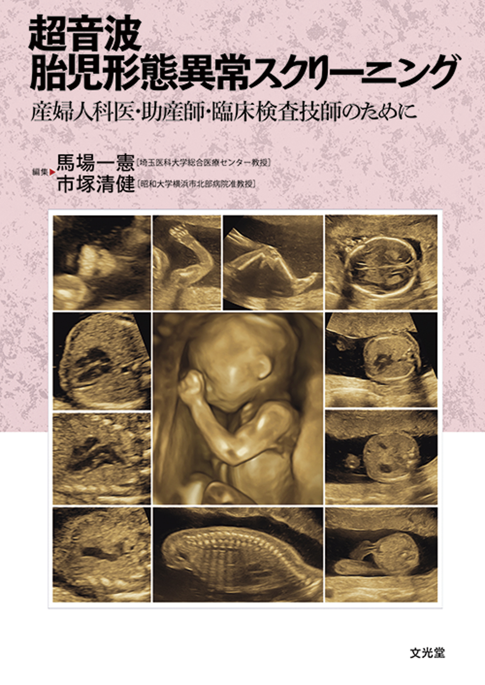 超音波胎児形態異常スクリーニングの商品画像