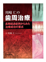川崎仁の歯周治療の商品画像