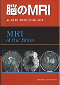 脳のMRIの商品画像